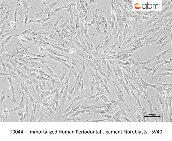 Immortalized Human Periodontal Ligament Fibroblasts - SV40 – Figure 1 of 1