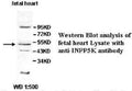 Anti-INPP5K Antibody – Figure 1 of 1