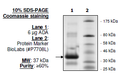 Adenosine Deaminase (ADA), His-tag Recombinant – Figure 1 of 1