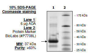 Adenosine Deaminase (ADA), His-tag Recombinant – Figure 1 of 1