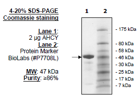 AHCY, S. solfataricus, His-tag Recombinant – Figure 1 of 1