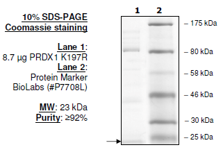 Peroxiredoxin I (K197R), His-tag Recombinant – Figure 1 of 1
