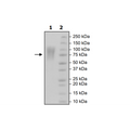 CEACAM, Avi-His-Tag, Biotin Labeled Recombinant – Figure 1 of 2