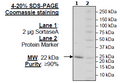 Sortase A, Heptamutant, His-Tag Recombinant – Figure 1 of 1