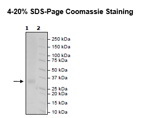 RANKL, His-Tag (Human) Recombinant – Figure 1 of 1