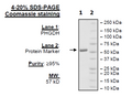 PHGDH, His-tag Recombinant – Figure 1 of 2