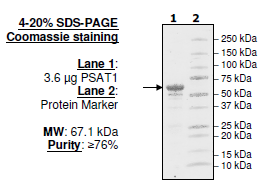PSAT1, GST-tag Recombinant – Figure 1 of 1