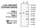 HEXB, FLAG-His-tags Recombinant – Figure 1 of 1