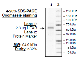 HEXB, FLAG-His-tags Recombinant – Figure 1 of 1