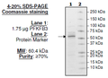 PFKFB3, His-tag Recombinant – Figure 1 of 2