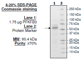 PFKFB3, His-tag Recombinant – Figure 1 of 2