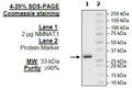 NMNAT1, His-Tag Recombinant – Figure 1 of 4