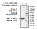 GPD1, His-tag Recombinant – Figure 1 of 1