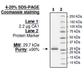 Carbonic Anhydrase 1 (CA1), His-tag Recombinant – Figure 1 of 2
