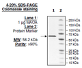 MAOA, His-tag, FLAG-Tag Recombinant – Figure 1 of 1