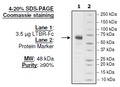 Human LTBR, Fc fusion HiP™ Recombinant – Figure 1 of 1