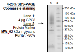 GPC3, His-tag [Monkey (M. fascicularis)] Recombinant – Figure 1 of 1