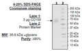 CD155 (PVR), His-tag (Mouse) HiP™ Recombinant – Figure 1 of 2