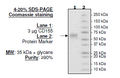CD155 (PVR), His-tag (Human) Recombinant – Figure 1 of 2