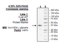 LAT, His-tag (Human) Recombinant – Figure 1 of 1