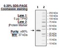 TPH2, His-tag (Human) Recombinant – Figure 1 of 2