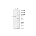Ash2L, His-tag Recombinant – Figure 1 of 1
