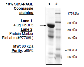 RbBP5, His-tag Recombinant – Figure 1 of 1