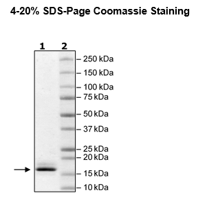 DPY30, His-tag Recombinant – Figure 1 of 1