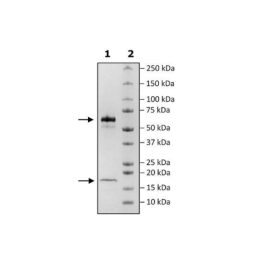 PCSK9, His-tag Recombinant – Figure 1 of 3