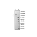 LDLR, FLAG-Avi-Tag, Biotin-Labeled Recombinant – Figure 1 of 3