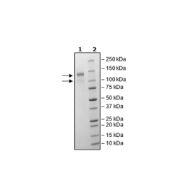 LDLR, FLAG-Avi-Tag, Biotin-Labeled Recombinant – Figure 1 of 3