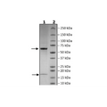 PCSK9(D374T), Biotin-labeled, HiP™ Recombinant – Figure 1 of 5