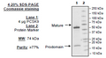 PCSK9, His-Avi-Tag (Mouse) Recombinant – Figure 1 of 1