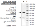 Anti-β-Amyloid, Plaque Neutralizing Antibody – Figure 1 of 1