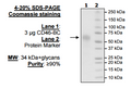 CD46-BC, His-tag (Human) Recombinant – Figure 1 of 1