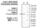 GLS2, His-tag Recombinant – Figure 1 of 5