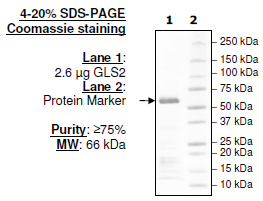 GLS2, His-tag Recombinant – Figure 1 of 5