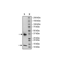 FcRn Complex (FCGRT/B2M), His-Avi-Tag, Biotin-Labeled, HiP™ Recombinant – Figure 1 of 4