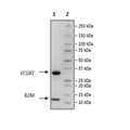 FcRn (FCGRT/B2M), His-Tag Recombinant – Figure 1 of 2