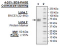 BACE1, His-Tag (Human) Recombinant – Figure 1 of 1