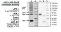 CD38, His-Tag, PE-labeled Recombinant – Figure 1 of 2