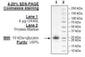OX40L (CD252), His-Tag (Mouse) Recombinant – Figure 1 of 2