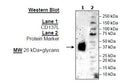 CD137L, His-Tag (Mouse) Recombinant – Figure 1 of 2
