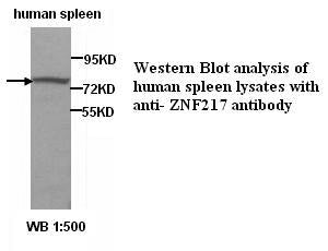 Anti-ZNF217 Antibody – Figure 1 of 1