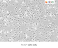 U251 Cells – Figure 1 of 1
