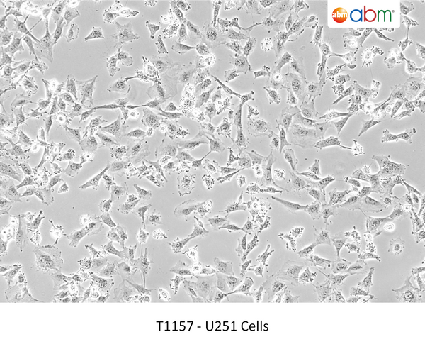U251 Cells – Figure 1 of 1