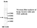 Anti-NSE Antibody – Figure 1 of 1