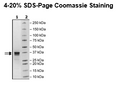 JAK2 (JH2 Domain), His-Avi-Tag, Biotin-Labeled Recombinant – Figure 1 of 3