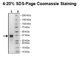 JAK2 (JH2 Domain), His-Avi-Tag, Biotin-Labeled Recombinant – Figure 1 of 3