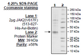JAK2 (V617F) (JH2 Domain), His-Avi-Tag, Biotin-Labeled Recombinant – Figure 1 of 1